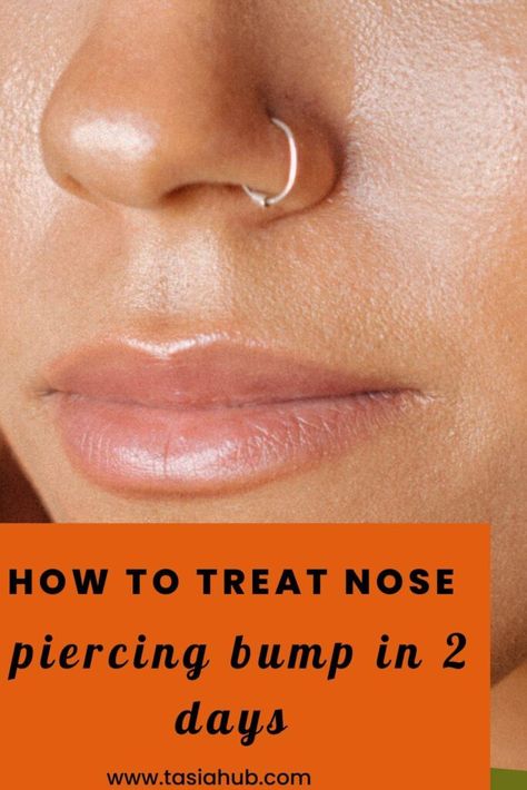 Nose Ring Bump, Nose Piercing Infection, Nose Piercing Care, Nose Piercing Healing, Nose Piercing Bump, Blood Blister, Nose Peircing, Piercing Bump, Blocked Nose