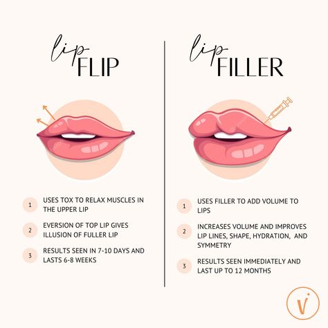 Lip Filler or Lip Flip at Med Spa in Platteville, Wisconsin Lip Pillow Filler, Lip Filler Tips, Needleless Lip Filler, Lip Flip Aesthetic, Lip Filler Captions Instagram, Types Of Lip Fillers, Lip Filler Timeline, Mini Lip Filler, Diy Lip Filler