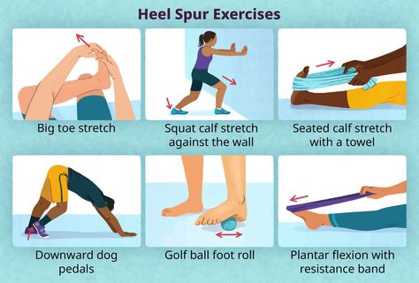 Heel Spur Exercises Exercises For Heel Spur, Heel Spur Relief Exercise, Bone Spur Heel, Heel Pain Exercises, Heal Spurs, Heel Spur Relief, Calcaneal Spur, Tens Unit Placement, Foot Pain Relief Remedies