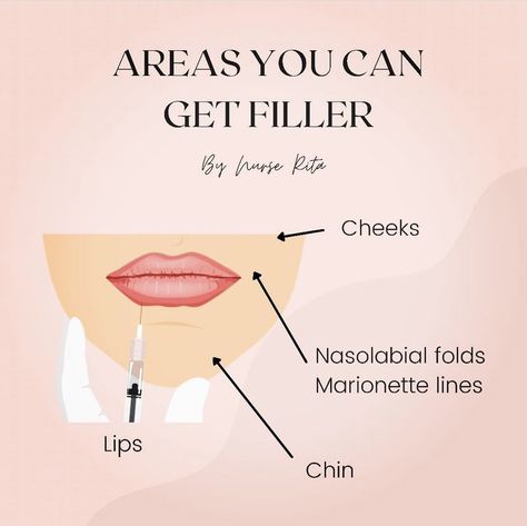 Cosmetic Nursing, Botox Funny, Botox Quotes, Botox Injection Sites, Cosmetic Fillers, Aesthetic Nurse, Nurse Injector, Aesthetic Dermatology, Botox Face