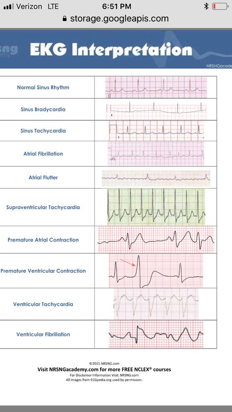 Heart Rythym Chart, Cardiology Terminology, Cardiac Nurse Aesthetic, Ekg Technician Aesthetic, Cardiac Nursing Cheat Sheets, Cardiovascular Technologist, Cardiology Study, Paramedic Student, Medical Terminology Study