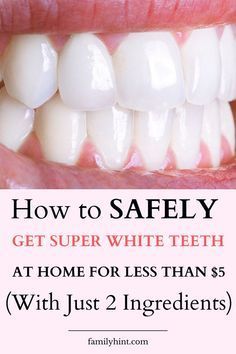 Whiten Your Teeth At Home, Whiten Teeth Naturally, Baking Soda Teeth, Baking Soda Teeth Whitening, Teeth Whitening Methods, Get Whiter Teeth, Teeth Whitening Homemade, Teeth Whitening Remedies, Teeth Whitening Diy