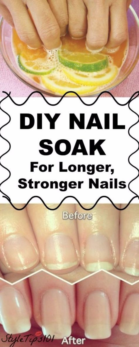 Diy Nail Soak, Do It Yourself Nails, Stronger Nails, Nail Soak, Nail Growth, Strong Nails, Manicure At Home, Healthy Nails, 3 Ingredient