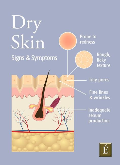 Dryskin Skincare, Dry Skin Causes, Skin Facts, Eminence Organic Skin Care, Skin Moles, Skin Care Routine For 20s, Scalp Oil, Avon Products, Perfectly Posh