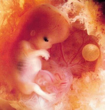 Baby In Womb, Human Embryo, In Utero, Basic Anatomy And Physiology, Earth Baby, Fetal Development, And So It Begins, Ap Art, Twin Babies