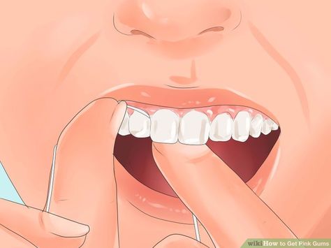 How to get pinker gums! Home Gum, Dark Gums, Swollen Gum, Teeth Whitening Homemade, Neck Exercises, Gum Health, Receding Gums, Natural Teeth Whitening, Hygiene Routine