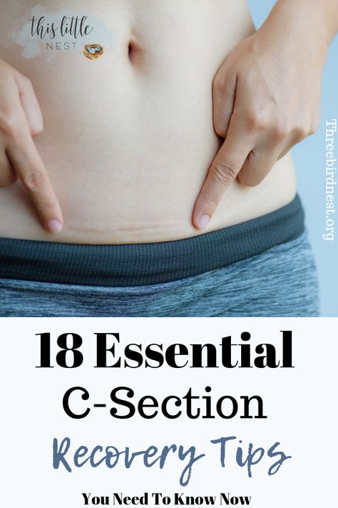 C-Sections can be brutal. Learn how to recover in record time with these essential tips. Click the pin to read more. #csection #csectionrecovery #childbirth #pregnancy C Section Recovery, Parenting Mistakes, Abdominal Surgery, Baby Kicking, Pregnancy Information, Pumping Moms, Baby Sleep Problems, C Section, Postpartum Recovery