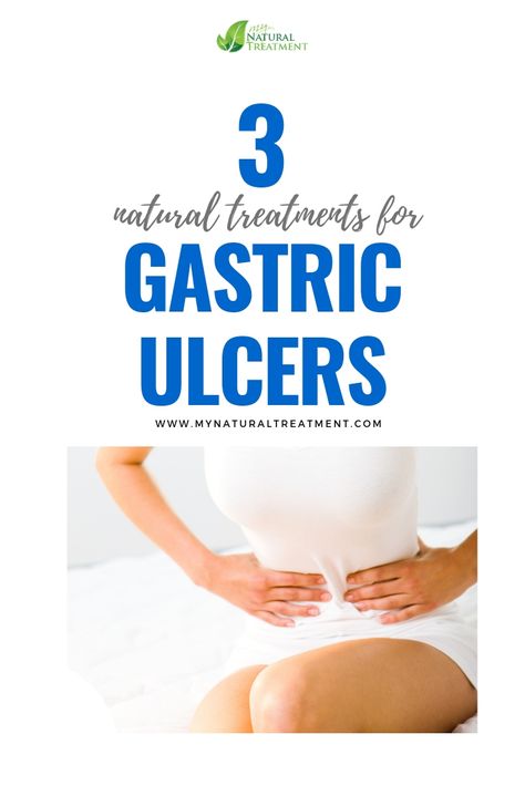 3 Natural Treatments for Gastric Ulcers based on Plants #gastriculcer #gastriculcers #gastriculcertreatment #gastriculcerremedy #gastriculcerremedies #gastriculcercure #stomachulcer #stomachulcerremedy #stomachulcercure Herbs To Heal Stomach Ulcers, Herbs For Stomach Ulcers, Natural Remedies For Ulcers, Heal Ulcers Naturally, Ulcers In Stomach Remedies, Stomach Remedies, Home Remedies For Allergies, Warts Remedy, Natural Remedies For Allergies