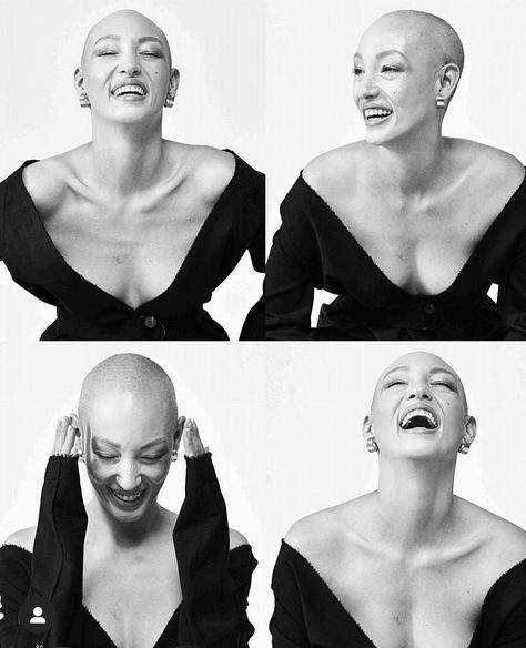 Bald Head Photoshoot, Alopecia Photo Shoot, Bald Model Photoshoot, Bald Woman Portrait, Bald Women Photoshoot, Bald Woman Photoshoot, Shaved Head Women Photoshoot, Alopecia Photography, Bald Photoshoot Ideas