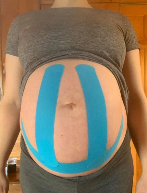 Tape Pregnant Belly, Pregnancy Running, Rib Pain, K Tape, Kinesio Tape, Kt Tape, Abdominal Discomfort, Kinesio Taping, Mother Runner