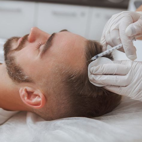 This month, try out Platelet Rich Plasma (PRP) treatments for hair growth! PRP injections contain many growth factors and can stimulate scalp hair growth in both men and women. Call 310-626-4631 for pricing info! #prp #hairloss Prp Hair, Female Pattern Baldness, Androgenetic Alopecia, Fue Hair Transplant, Stimulate Hair Follicles, Pattern Baldness, Aesthetic Clinic, New Hair Growth, Hair Follicles