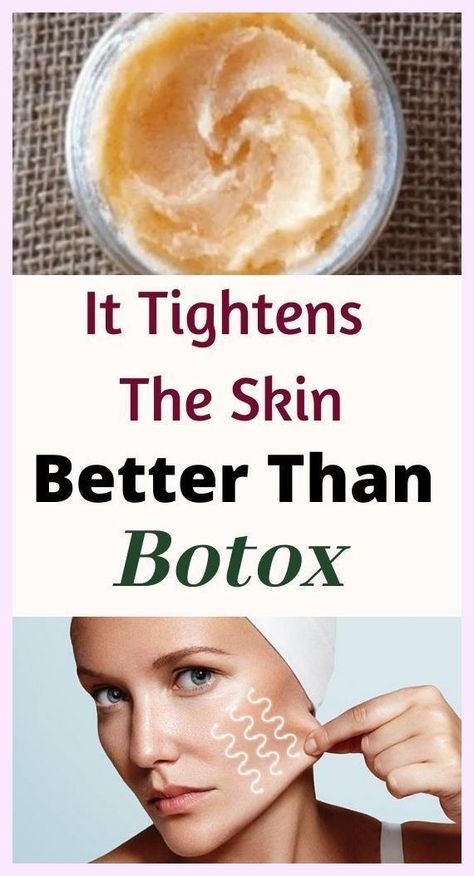 Skin Tightening Homemade Wrinkle Cream That Works Better Than Botox Homemade Wrinkle Cream, Coffee Face Mask, How To Remove Pimples, Gorgeous Skin, Homemade Face, Homemade Face Masks, Skin Complexion, Wrinkle Cream, Natural Home Remedies