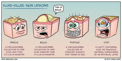 Image result for medcomic Wound Care Nursing, Skin Lesions, Medical Mnemonics, Nursing Mnemonics, Med Surg, Nursing School Notes, Nursing Tips, Wound Care, Nursing Study