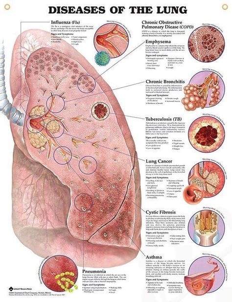 Lung Anatomy, Anatomy Poster, Body Diagram, Medical Student Study, Pulmonology, Respiratory Care, Nursing School Survival, Respiratory Therapy, Nursing School Studying