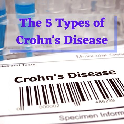 The 5 Types of Crohn’s Disease - Crohn’s is a type of Inflammatory Bowel Disease (IBD) characterized by chronic inflammation and erosion of the intestines. Unlike Ulcerative Colitis, which only affects the colon, Crohn’s can affect any part of the digestive tract. Symptoms can range in severity, just like the disease itself from mild to severe. Symptoms can include; abdominal pain, fever, Chrons Disease Symptoms Crohns, Chrons Disease Symptoms, Crohns Symptoms, Crohns Diet, Chrons Disease, Inflammatory Bowel, Digestive Tract, Inflammation Causes, Disease Symptoms