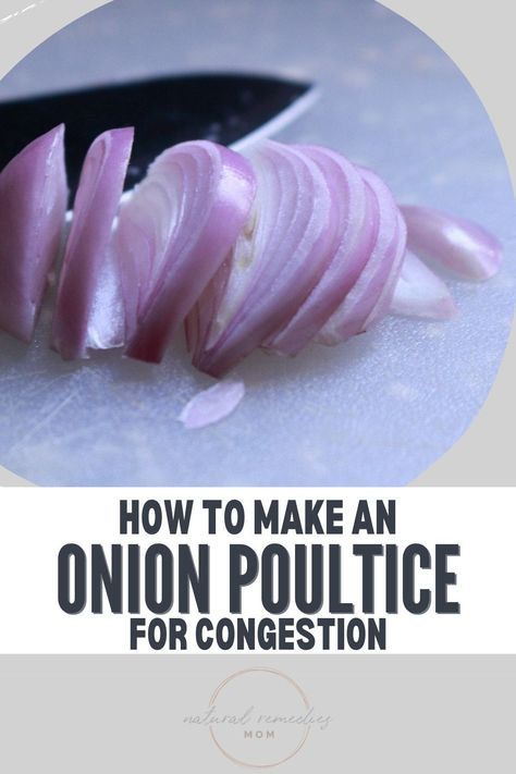 An onion poultice can be an effective remedy for congestion, and it’s simple to make! Here's the instructions. Onion Poultice, Coldsore Remedies Quick, Dry Cough Remedies, Natural Mom, Home Remedy For Cough, Cold Sores Remedies, Natural Sleep Remedies, Natural Cold Remedies, Cold Home Remedies