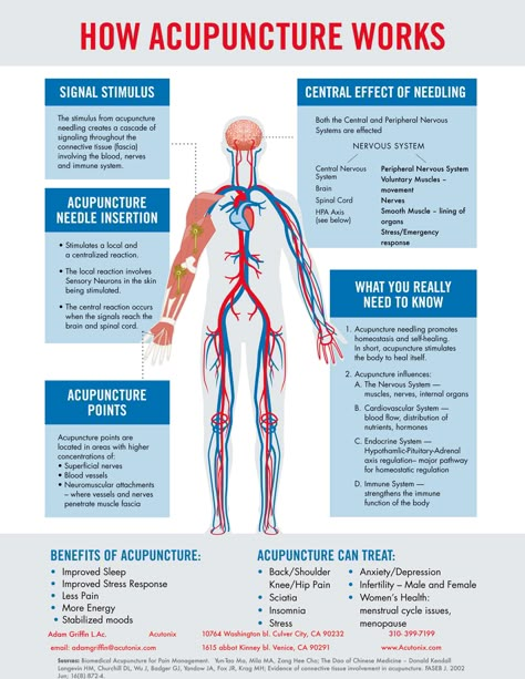 Acupuncture Points Chart, Acupuncture Needle, Acupuncture Benefits, Energy Healing Reiki, Energy Medicine, Acupuncture Points, Acupressure Points, Qi Gong, Holistic Medicine