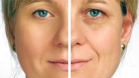 Sallow Skin: Causes, Remedies, and More Sallow Skin, Creme Anti Age, Anti Aging Creme, Anti Aging Wrinkles, Anti Aging Beauty, Anti Aging Face, Anti Wrinkle Cream, Wrinkle Cream, Moisturizing Body Wash