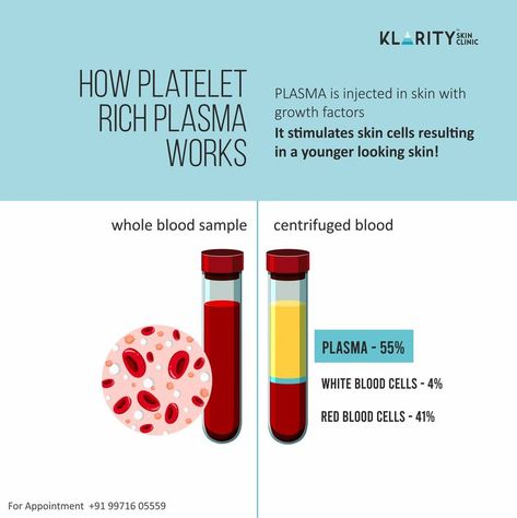 Prp Therapy, Platelet Rich Plasma, Botox Fillers, Facial Rejuvenation, White Blood Cells, Growth Factor, Skin Clinic, Red Blood Cells, Collagen Production