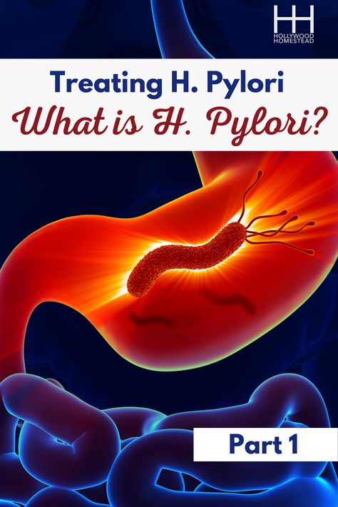 Our first post in this series breaks down what H Pylori is and how it compares to similar bacteria or stomach conditions. If you experience painful stomach ulcers, you’re going to want to read this: What Is H Pylori? Hpylori Diet Natural Remedies, Hpylori Diet, Stomach Bacteria, H Pylori, Homestead Blog, Different Fruits And Vegetables, Small Intestine Bacterial Overgrowth, Natural Face Cleanser, Stomach Ulcers