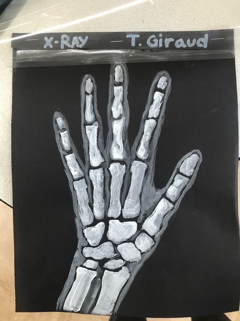 Black construction trace hand white draw bones white tempera for bones black mixed with white (grey) for hand outline cover with transparency for effect. X Ray Painting, Halloween Art High School, Hand Tracing Art, Skeleton Art Projects, X Ray Drawing, X Ray Skeleton, Art Projects Elementary, Skeleton Drawing, Hand Skeleton