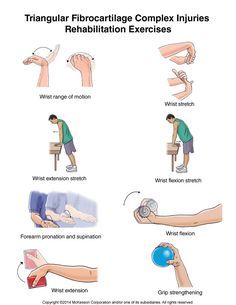 TFCC Exercises. Ulnar exercises. Wrist strengthening. Hand Therapy Exercises, Sprained Wrist, K Tape, Rehabilitation Exercises, Wrist Exercises, Physical Therapy Exercises, Hand Exercises, Wrist Pain, Hand Therapy