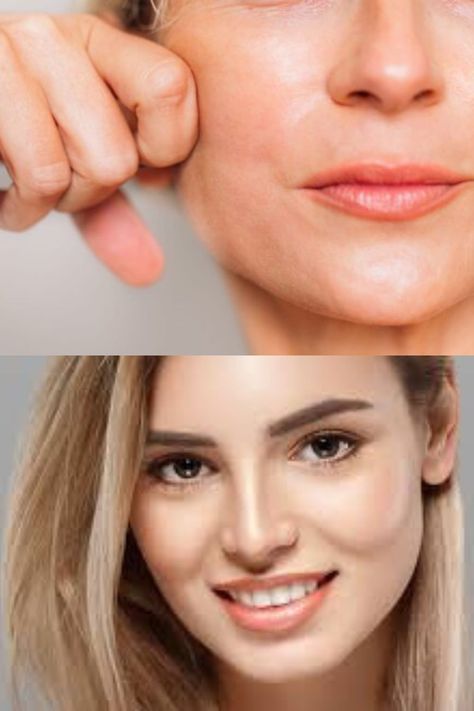 FaceTite- Behacks.com Facetite Procedure, Surgical Procedures, Skin Aesthetics, Facial Rejuvenation, Beauty Treatments, New You, The Field, The Magic, Beauty Hacks