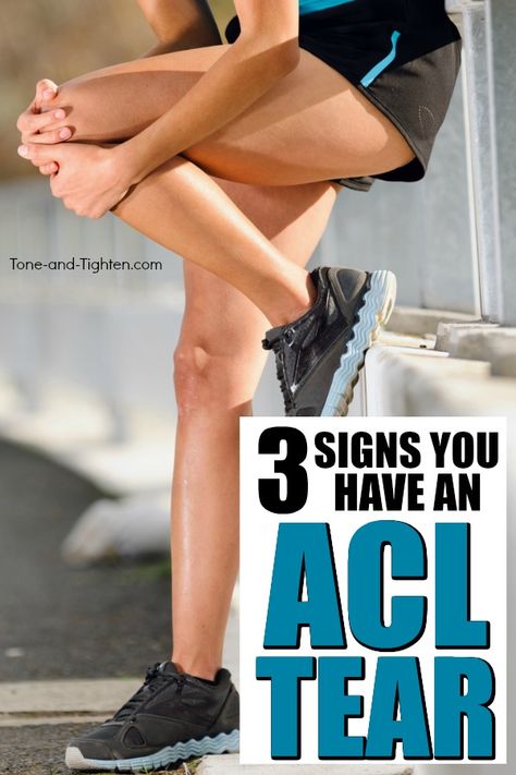 How to check if you have an ACL injury - 3 simple tests you can do at home to test your knee pain. Acl Knee, Anterior Cruciate Ligament, Muscle Knots, Acl Tear, Cruciate Ligament, Sciatic Nerve Pain, Knee Injury, Nerve Pain, Physical Therapist