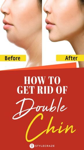 Rid Of Double Chin, Sagging Cheeks, Double Chin Exercises, Reduce Double Chin, Chin Exercises, Neck Firming, Tighten Loose Skin, Skin Bumps, Simple Exercises