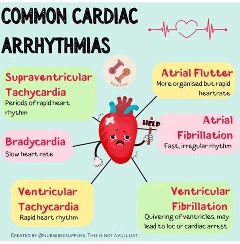 Arrhythmias Notes, Paramedic Study, Nursing Knowledge, Sonography Student, Nurse Things, Paramedic School, Nurse Study, Cardiac Rhythms, New Grad Nurse