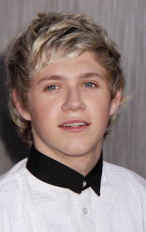 Niall Horan Braces In Braces Skz, Braces Men, I.n With Braces, Vernon Braces, Celebrities With Braces, Niall Horan Braces, Niall Horan With Braces, Niall Horan News, Adult Braces