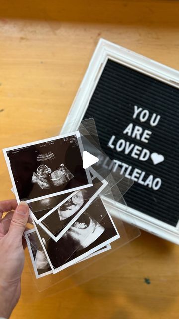 Eudora on Instagram: "I’ve been looking for a way to protect and store away my many ultrasound photos - and self-laminating sheets seem to be the best solution I’ve found (besides taking photos of them to have digital copies). I still have all of my ultrasound photos from my pregnancy with Jonah that I’ll be self-laminating next. Fellow Mamas and Parents: Save this and/or share with someone…and let me know if you’ll give this a try! #ultrasoundphoto #pregnancy #3M #diy #momlife #igreels" Ultrasound Wallpaper, Sonogram Picture Ideas, Baby 12 Months, Sonogram Pictures, Baby Ultrasound, Ultrasound Pictures, Maternity Poses, Baby Shower Diapers, Ultrasound