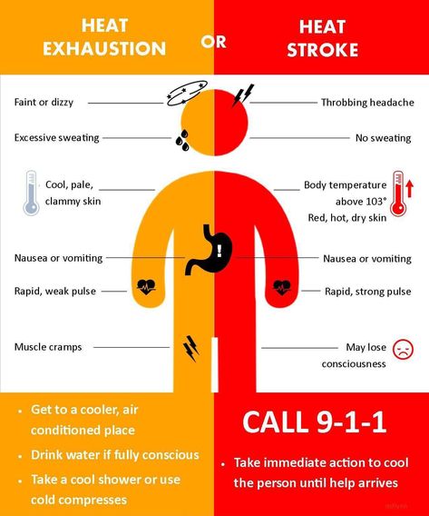 Heat exhaustion vs heat stroke Camp Nurse, Throbbing Headache, Heat Exhaustion, First Aid Tips, Excessive Sweating, School Nurse, Athletic Training, Medical Knowledge, Nclex