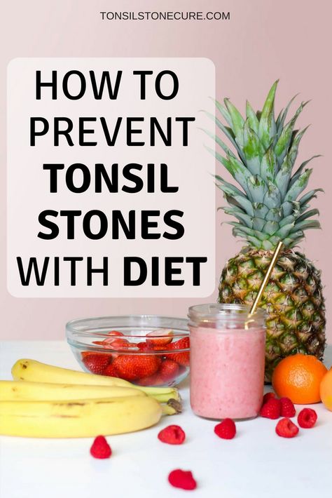 There’s a lot of mixed information and opinions on whether or not certain foods and drinks cause tonsil stones. For some, diet has a direct correlation to their tonsil stones; while others get tonsil… First Time Mom Advice, Love Mama, Summer Smoothies, New Mom Tips, Baby On A Budget, Smoothie Detox, Mommy Tips, Juice Plus, Feeding Baby