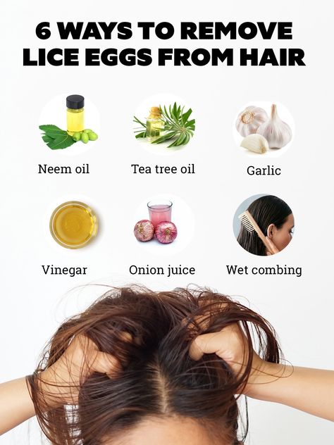 How To Remove Lies Eggs From Hair, How To Remove Lice From Head, Hair Mask For Lice, How To Remove Oil From Hair, Lice Hair Removal, Lice Removal Home Remedies, How To Remove Lice Eggs From Hair, How To Remove Lice From Hair, Lice Eggs Removal