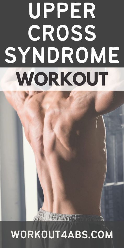 Upper Cross Syndrome Exercises - Workout4Abs Upper Cross Syndrome Exercises, Upper Cross Syndrome, Workouts To Get Abs, Core Exercises For Women, Myofascial Pain Syndrome, Complete Workout, Best Core Workouts, Core Exercise, Correct Posture