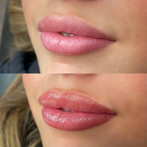 This before and after lip tattoo 🤍 One of my favorite lip sessions using @permablend_pigments Tender Carmel (RIP because I’m pretty sure this color has been discontinued 😢) This client had a beautiful, natural pink hue to their lips that a lot of people desire when getting their lip blush done. 🎀 We wanted to stick close to the lips natural shade, but enhance the color by adding a warm, nude touch. Adding the touch of warmth really helped define the lip shape and complement the clients feat... Lip Blushing Tattoo Colors, Lip Blushing Tattoo Before And After, Honey Makeup, 2025 Manifestation, Lip Permanent Makeup, Pretty Poison, Lip Blushing, Lips Tattoo, Lip Blush