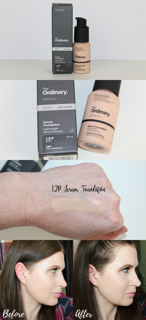 Ordinary Serum Foundation, Ordinary Foundation, The Ordinary Soothing Barrier, The Ordinary Niacinamide 10% + Zinc 1% Before And After, The Ordinary Foundation, The Ordinary Glycolic Acid 7% Toning Solution, Origins Ginzing Serum, Ordinary Serum, The Ordinary Serum