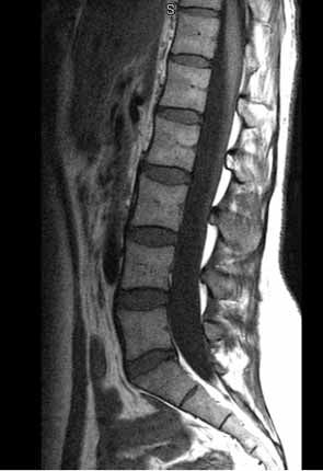 Ct Vs Mri, Mri Spine, Mri Technologist Student, Lumbar Mri Anatomy, Mri Brain, Healthy Spine, Get Shot, X Ray, Vision Board