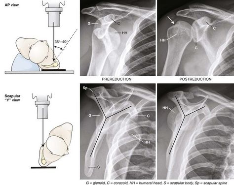 X Ray Positioning, Radiology Positioning, X Ray Student, Xray Positioning, X Ray Anatomy, Radiology Notes, Xray School, Radiography Student, Rad Tech Student