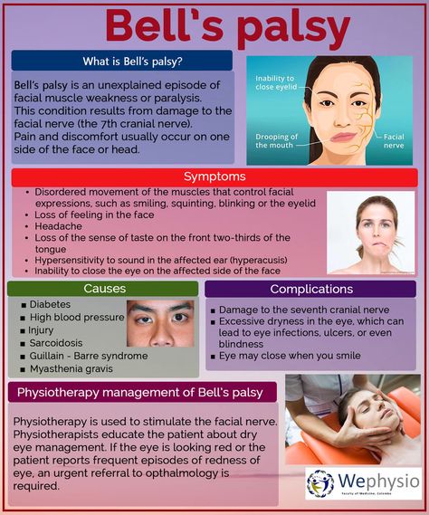 Bell’s palsy Bell’s Palsy, Bells Palsy, Nursing School Essential, Muscle Twitching, Facial Nerve, Nurse Study Notes, Nursing Student Tips, Physical Therapy Exercises, Nursing School Survival