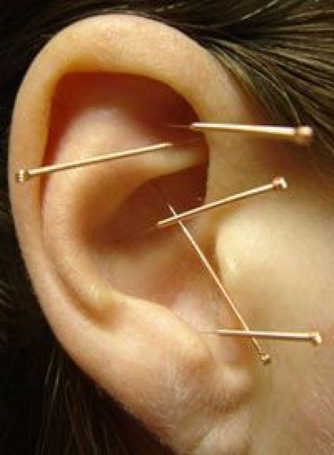 Acupuncture Benefits, Vagus Nerve, Acupuncture Points, Acupressure Points, Good Mental Health, Chinese Medicine, Acupressure, Alternative Medicine, Acupuncture