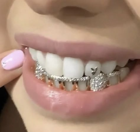 Braces, Close Up, A Woman, Diamonds, Pink