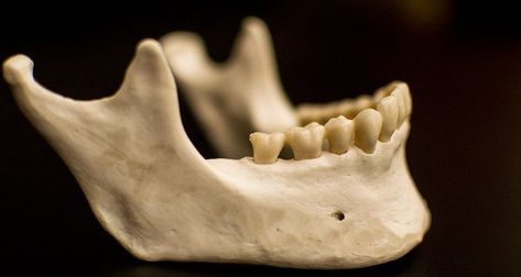 Human jaw | Before agriculture, human jaws were a perfect fit for human teeth. The emergence of agricultural practices initiated major changes to the jaw structure of ancient humans, leading to dental problems we still experience. Animal Jaw Bone, Bone Reference, Skull Anatomy, Skull Reference, Human Teeth, Vulture Culture, Animal Anatomy, Anatomy Study, Skull Logo