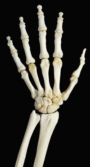 Bones Of The Hand, Human Hand Bones, Hand Anatomy, Nurse School, Skeleton Anatomy, Hand Photo, Medical Anatomy, Hand Reference, Hand Wrist