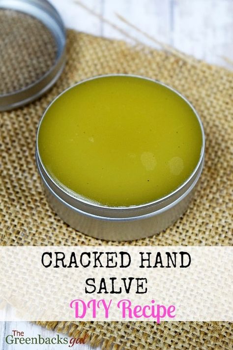 Hand Cream Homemade, Hand Salve, Salve Recipes, Cracked Hands, Diy Lotion, Homemade Lotion, Diy Kosmetik, Hand Creams, Homemade Bath Products