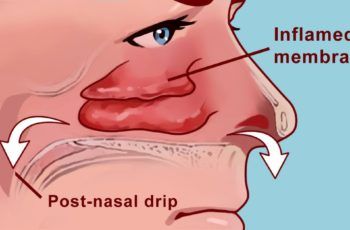 How to clear your sinuses with nothing but your fingers (video below) Remedy For Sinus Congestion, Clear Your Sinuses, Blocked Sinuses, Sinus Drainage, Sinus Remedies, Home Remedies For Sinus, Relieve Sinus Pressure, Lymph Drainage Massage, How To Clear Sinuses