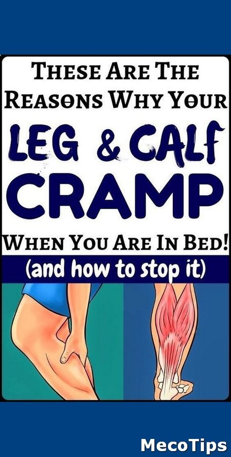 Severe Leg Cramps, Health Body And Mind, Coconut Oil Remedies, Calf Cramps, Tips For Good Health, Medical Herbs, Doctor Advice, Leg Cramps, Oil Remedies