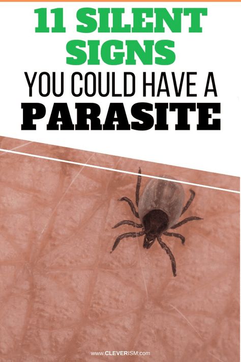 11 Silent Signs You Could Have a Parasite. Most people suffer unknowingly from parasites. Here's the definitive checklist. Find out whether you have parasites or not.  - #SilentSignsYouHaveAParasite #Parasites #Cleverism Parasites Symptoms, Skin Parasites, Toxic Off, Parasite Cleanse, Health Articles Wellness, Wellness Clinic, Job Interview Tips, Career Quotes, Stomach Pain