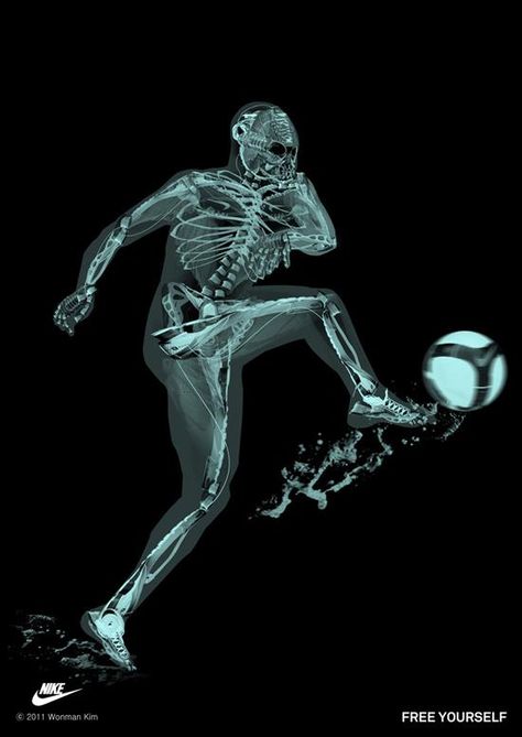 Radiology - Radiology News and Blogs - radRounds Radiology Network Radiology Humor, Xray Art, Special Forces Gear, Xray Technician, Bone Collector, Nike Wedges, Nike Air Max 2015, The Good Son, Nike Design